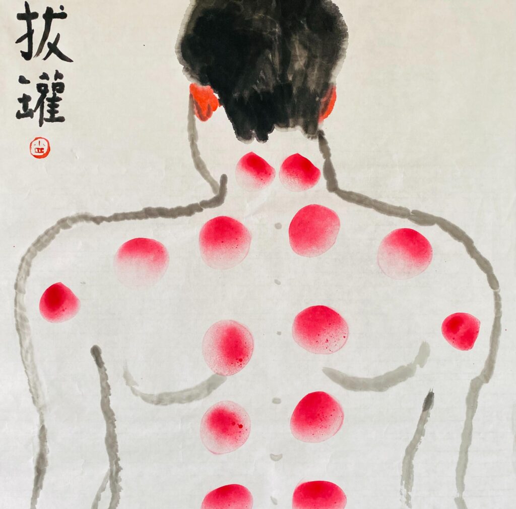 蔡宗祐〈拔罐圖〉，2023，水墨、噴漆、水性顏料，70x69_cm，藝術家自藏。圖片來源：藝術家提供。